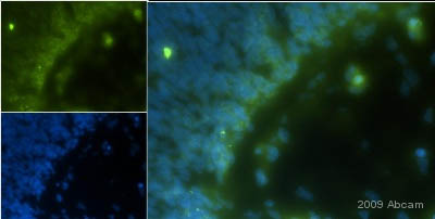 ab3508 at a 1/2000 dilution staining Vitamin D Receptor in whole Rat embryo tissue sections by Immunohistochemistry (frozen sections) incubated for 16 hours at 25°C. Samples fixed in 4% PFA prior to cutting at 30µm thickness. Blocked with 5% serum for 1 hour at 25°C. Secondary used at 1/200 polyclonal Goat anti-rabbit conjugated to Alexa Fluor 488.See Abreview