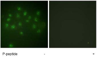 Immunofluorescent staining of A549 cells, using ab63572 at a 1/500 dilution, minus immunising peptide (left image) and plus immunising peptide (right image).