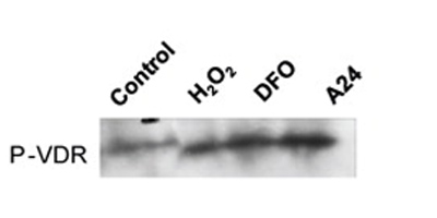 developed using the ECL technique©Callens et al., 2010. Originally published in The Journal of Experimental Medicine. doi: 10.1084/jem.20091488.