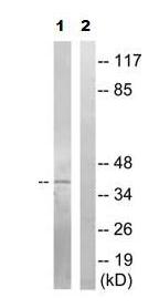All lanes : Anti-Vitamin D Receptor (phospho S51) antibody (ab79311) at 1/500 dilutionLane 1 : COLO cells extract treated with insulin (0.01U/ml, 15mins)Lane 2 : COLO cells extract treated with insulin (0.01U/ml, 15mins) with Immunizing phosphopeptide at 5 µgLysates/proteins at 5 µg per lane.