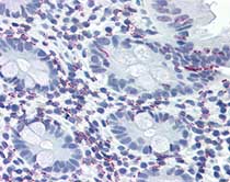 ab115495, at 10 &microg/ml, staining Vitamin D Receptor in formalin-fixed, paraffin-embedded Human Colon tissue by Immunohistochemistry using a biotinylated secondary antibody, alkaline phosphatase-streptavidin and chromogen.