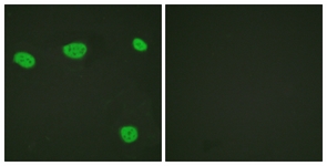 Immunofluorescence analysis of HeLa cells labelling Vitamin D Receptor with ab134826 at 1/100 dilution. The image on the right is treated with the synthesized peptide.