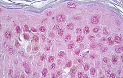 Immunohistochemical analysis of Formalin-fixed, Paraffin-embedded Human Skin tissue labelling Vitamin D Receptor with ab134826 at 5 µg/ml.