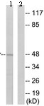 All lanes : Anti-Vitamin D Receptor antibody (ab134826) at 1/500 dilutionLane 1 :  MCF7 cell extractsLane 2 :  MCF7 cell extracts with synthesized peptide