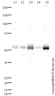 All lanes : Anti-Vitamin D Receptor antibody (ab82566) at 1 µg/mlLane 1 : Skin (Human) Tissue Lysate - adult normal tissue (ab30166)Lane 2 : Thyroid (Human) Whole Cell Lysate - adult normal tissue (ab29636)Lane 3 : Small Intestine (Human) Tissue Lysate - adult normal tissue (ab29276)Lane 4 : Bone Marrow (Human) Tissue Lysate - adult normal tissueLane 5 : Kidney (Human) Tissue Lysate - adult normal tissue (ab30203)Lysates/proteins at 10 µg per lane.SecondaryGoat polyclonal to Rabbit IgG - H&L - Pre-Adsorbed (HRP) at 1/3000 dilutiondeveloped using the ECL techniquePerformed under reducing conditions.