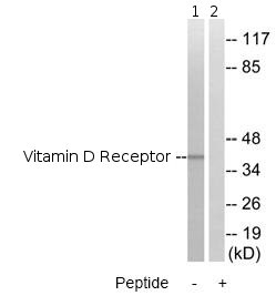 All lanes : Anti-Vitamin D Receptor antibody (ab79513) at 1/500 dilutionLane 1 : Extracts from Jurkat cellsLane 2 : Extracts from Jurkat cells with immunising peptide at 10 µgLysates/proteins at 30 µg per lane.