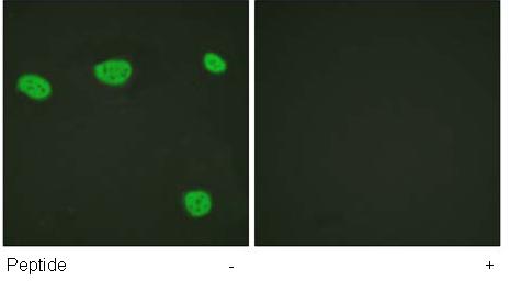 Immunofluorescence analysis of HeLa cells, using ab61781 antibody at 1/500 dilution in the presence and absence of the immunizing peptide
