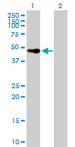 All lanes : Anti-Vitamin D Receptor antibody (ab89626) at 1 µg/mlLane 1 : Vitamin D Receptor transfected 293T cell lysateLane 2 : Non-transfected 293T cell lysateLysates/proteins at 25 µg per lane.
