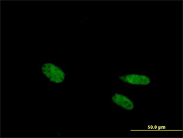 ab89626 at 10µl/ml staining Vitamin D Receptor on HeLa cell by immunofluorescence