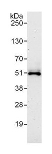Detection of Vitamin D Receptor by Western Blot of Immunprecipitate. Anti-Vitamin D Receptor antibody at 1µg/ml staining Vitamin D Receptor in HeLa whole cell lysate immunoprecipitated using ab131012 at 6µg/mg lysate (1 mg/IP; 20% of IP loaded/lane). Detection: Chemiluminescence with exposure time of 3 minutes.