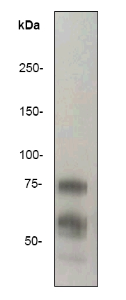 Anti-Vitronectin antibody [EP781Y] (ab46808) at 1/20000 dilution + 10ug Human serumSecondaryGoat anti-rabbit, HRP labelled. at 1/2000 dilution