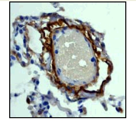 This image shows human lung tissue treated with ab46808 at 1/100 dilution.