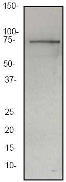 Anti-Vitronectin antibody [EP873Y] (ab45139) at 1/20000 dilution + Hu Serum membrane at 10 µgSecondaryGoat anti-rabbit HRP labelled, at 1/2000 dilutionObserved band size : 75 kDa (why is the actual band size different from the predicted?)