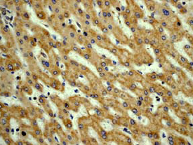 Ab45139 at a 1/100 dilution, staining human Vitronectin in human liver tissue by immunohistochemistry using paraffin embedded tissue.