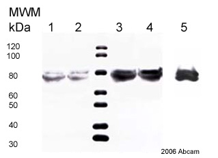 All lanes : Anti-Vitronectin antibody [VIT-2] (ab11591) at 1/1500 dilutionLane 1 : 25ul Human csf 3 days post injuryLane 2 : 25ul Human csf 4 days post injuryLane 3 : 25ul Human csf 5 days post injuryLane 4 : 25ul Human csf 6 days post injuryLane 5 : 0.365ug recombinant vitronectinSecondaryHRP conjugated sheep anti-mouse IgGdeveloped using the ECL techniquePerformed under non-reducing conditions.Observed band size : 65,75 kDa (why is the actual band size different from the predicted?)Exposure time :  2 minutesThis image is courtesy of an Abreview submitted by Dr Anki NordqvistSee Abreview