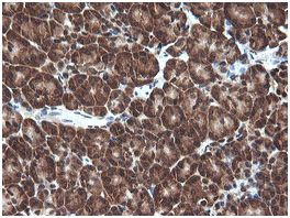 Immunohistochemical analysis of paraffin embedded Human pancreas tissue labeling Von Hippel Lindau with ab140989 at a 1/150 dilution.