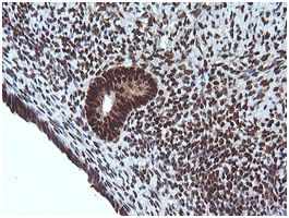 Immunohistochemical analysis of paraffin embedded Human endometrium tissue labeling Von Hippel Lindau with ab140989 at a 1/150 dilution.
