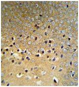 Immunohistochemical analysis of formalin fixed, paraffin embedded Mouse brain tissue labelling Von Hippel Lindau with ab135576 at 1/50. Detection utilised peroxidase conjugation to the secondary antibody, followed by DAB staining.