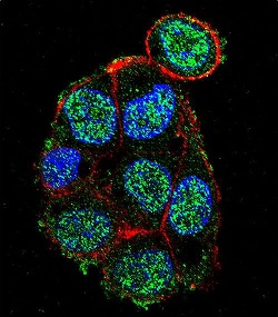 Confocal immunofluorescent analysis of HepG2 cells labelling Von Hippel Lindau with ab135576 at 1/10 followed by Alexa Fluor 488 conjugated Goat anti Rabbit lgG (green). Actin filaments have been labeled with Alexa Fluor 555 phalloidin (red). DAPI was used to stain the cell nuclear (blue).