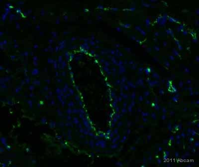 ab11713 staining Von Willebrand Factor in porcine heart tissue by Immunohistochemistry (Frozen sections).Tissue was fixed in acetone, permeabilized using 0.3% Triton/PBS, blocked with 10% serum for 30 minutes at 22°C and then incubated with ab11713 at a 1/50 dilution for 16 hours at 4°C. The secondary used was a FITC conjugated donkey anti-sheep polyclonal used at a 1/1000 dilution.See Abreview