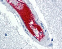 ab115771, at 5 ug/ml, staining Von Willebrand Factor in Formalin-fixed, Paraffin embedded Human Brain Cortex (vessel) by Immunohistochemistry followed by biotinylated secondary antibody, alkaline phosphatase-streptavidin and chromogen.