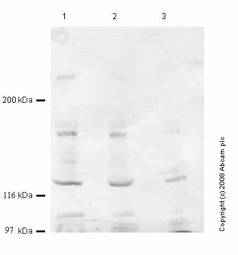 All lanes : Anti-Von Willebrand Factor antibody (ab47151) at 1/1000 dilutionLane 1 : Human serum. Reduced buffer at 1 µlLane 2 : Human serum. Reduced buffer at 0.5 µlLane 3 : Human serum. Reduced buffer at 0.25 µl