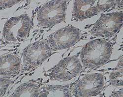 ab93708, at 1/100 dilution, staining Von Willebrand Factor in formalin-fixed, paraffin-embedded Human colon tissue by Immunohistochemistry.