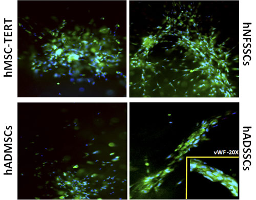 ab20435, staining Von Willebrand Factor (green) in hMSC-TERT, hADMSC, hADSSC and hNFSSC cells by Immunocytochemistry/ Immunofluorescence. Cells were fixed in paraformaldehyde and permeabilized with 0.1% Triton X-100 for 10 min. After washing with PBS, cells were blocked with 3% BSA for 30 min and incubated with primary antibody at 10 µl/ml, at 4°C overnight. A FITC-conjugated goat anti-mouse polyclonal IgG (1/4000) was used as the secondary antibody.