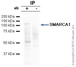 SMARCA1 was immunoprecipitated using 0.5mg Jurkat whole cell extract, 5µg of Rabbit polyclonal to SMARCA1 and 50µl of protein G magnetic beads (+). No antibody was added to the control (-). The antibody was incubated under agitation with Protein G beads for 10min, Jurkat whole cell extract lysate diluted in RIPA buffer was added to each sample and incubated for a further 10min under agitation.Proteins were eluted by addition of 40µl SDS loading buffer and incubated for 10min at 70oC; 10µl of each sample was separated on a SDS PAGE gel, transferred to a nitrocellulose membrane, blocked with 5% BSA and probed with ab37003.Secondary: Mouse monoclonal [SB62a] Secondary Antibody to Rabbit IgG light chain (HRP) (ab99697).Band: 105kDa: SMARCA1.