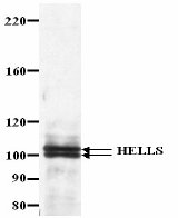 Detection of Human HELLS by Western Blot of Immunoprecipitate using Affinity Purified Rabbit anti-HELLS (ab3851).Sample: Nuclear Extract (1mg) from HeLa cellsAntibody: Affinity purified Rabbit anti-HELLS (ab3851)IP - 2µg. WB - 0.5µg/mlDetection: ECL, 30 seconds 