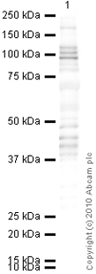 Anti-SMARCA6 antibody (ab3851) at 1 µg/ml + Thymus (Human) Tissue Lysate - adult normal tissue (ab30146) at 10 µgSecondaryGoat Anti-Rabbit IgG H&L (HRP) preadsorbed (ab97080) at 1/5000 dilutiondeveloped using the ECL techniquePerformed under reducing conditions.