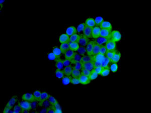 Immunofluorescence analysis of HepG2 cells labeling VPS28 with ab167172 at 1/100 dilution.