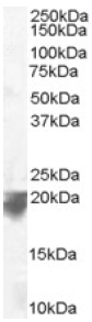 Anti-VPS29 antibody (ab10160) at 0.1 µg/ml + Human Spleen lysate (RIPA buffer, 35µg total protein per lane)