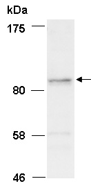 Anti-SMARCA6 antibody - N-terminal (ab135096) at 1/1000 dilution + HeLa total cell extract