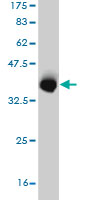 Western blot against tagged recombinant protein immunogen using ab57632 VPS35 antibody at 1ug/ml. 