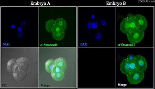 4-cell stage mouse embryos were recovered and the zona pellucida removed. ab67548 at 1:250 dilution was used to detect SMARCAD1, and as secondary antibldy embryos were incubated in Alexa-fluor488 conjugated donkey anti-mouse IgG. Embryos were then imaged by fluorescence confocal microscopy and projected confocal stack images generated - as shown in two examples. Please see accompanying abreview for additional information.See Abreview