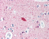 ab115611, at 5µg/ml, staining SmarcAL1 in Formalin-fixed, Paraffin-embedded Human brain cortex tissue by Immunohistochemistry followed by biotinylated secondary antibody, alkaline phosphatase-streptavidin and chromogen.