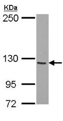 Anti-SmarcAL1 antibody (ab154226) at 1/500 dilution + A549 whole cell lysate at 30 µg
