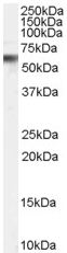 Anti-VPS45A antibody (ab52013) at 0.3 µg/ml + Human Peripheral Blood Mononucleocyte lysate (35µg protein in RIPA buffer).