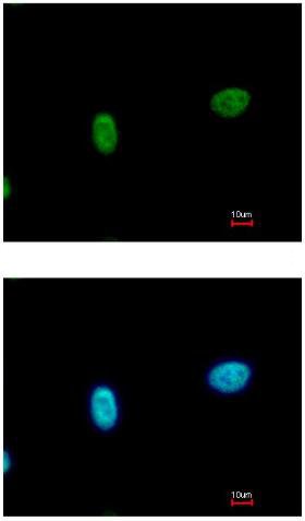 Immunofluorescence analysis of paraformaldehyde-fixed A549 cells, labeling SmarcAL1 with ab154226 at a 1/500 dilution (top image), and costained with Hoescht 33342 (bottom image).