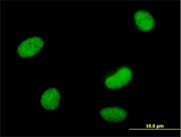 Immunofluorescence analysis of HeLa cells labeling SmarcAL1 with ab169092 at 10 µg/ml.