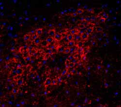 ab31895 staining mouse inferior olive using Cy3-conjugated donkey anti-rabbit secondary antibodies (red color) and DAPI (blue) as a nuclear counterstain.