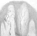 Immunolocalization of VR1 in human glabrous skin using ab3487.
