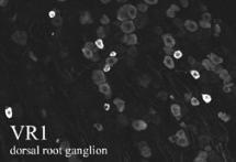ab10295, at a dilution of 1/1000, staining VR1 in rat dorsal root ganglion by Immunohistochemistry (PFA perfusion fixed frozen sections).