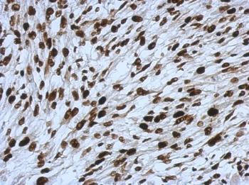 ab126180, at 1/500 dilution, staining SMARCC1 in paraffin-embedded Mouse C2C12 xenograft tissue by Immunohistochemistry.