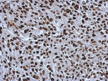 ab126180, at 1/500 dilution, staining SMARCC1 in paraffin-embedded Rat RT2 xenograft tissue by Immunohistochemistry.