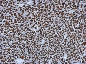 ab126180, at 1/500 dilution, staining SMARCC1 in paraffin-embedded Human BT483 xenograft tissue by Immunohistochemistry.