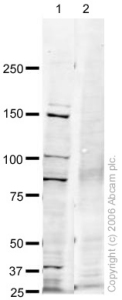 All lanes : Anti-SMARCC1 antibody (ab22355) at 1 µg/mlLane 1 : HeLa (Human epithelial carcinoma cell line) Whole Cell Lysate at 20 ug Lane 2 : HeLa (Human epithelial carcinoma cell line) Whole Cell Lysate at 20 ug with Human SMARCC1 peptide (ab24351) at 1 µg/mlSecondaryGoat polyclonal to Rabbit IgG (Alexa Fluor® 680) at 1/10000 dilution