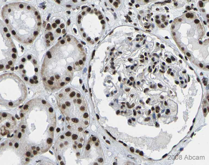 Image courtesy of Human Protein Atlasab22355 staining SMARCC1in human kidney. Paraffin embedded human kidney tissue was incubated with ab22355 (1/2000 dilution) for 30 mins at room temperature. Antigen retrieval was performed by heat induction in citrate buffer pH 6. ab22355 was tested in a tissue microarray (TMA) containing a wide range of normal and cancer tissues as well as a cell microarray consisting of a range of commonly used, well characterised human cell lines. Further results for this antibody can be found at www.proteinatlas.org