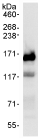 Detection of SMARCC1 by Western Blot of Immunprecipitate. ab72503 at 1µg/ml staining SMARCC1 in HeLa whole cell lysate immunoprecipitated using ab72503 at 3µg/mg lysate (1 mg/IP; 20% of IP loaded/lane). Detection: Chemiluminescence with exposure time of 1 second.